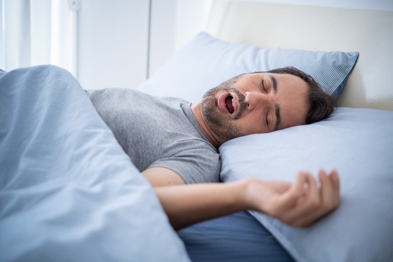 Thérapie myofonctionnelle (exercices oropharyngés) pour l’apnée obstructive du sommeil
