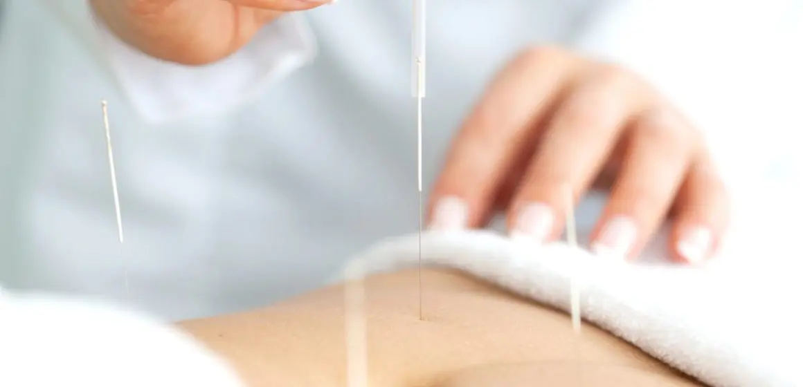 acupuncture plancher pelvien