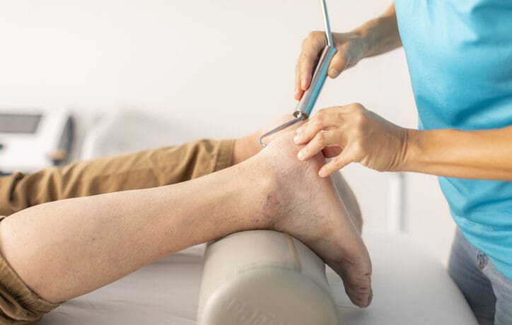 Techniques de crochetage myo-aponévrotique