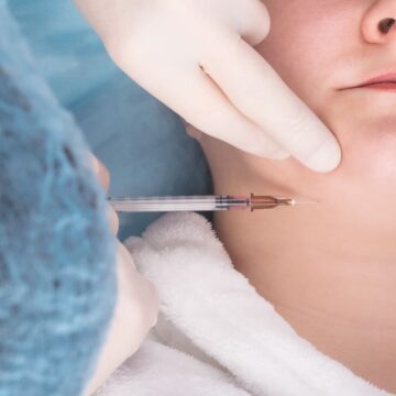 formation-kine-fknl-nancy-lorraine-injection-polynucleotides