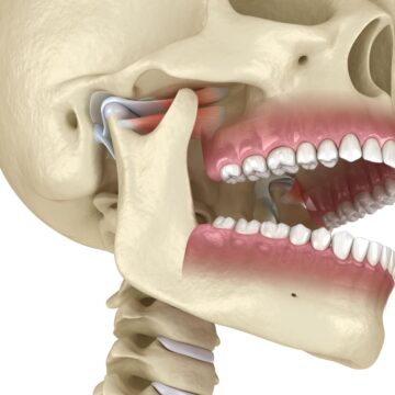formation-kine-ankylose-temporomandibulaire-fknl-centre-kine-nancy-lorraine