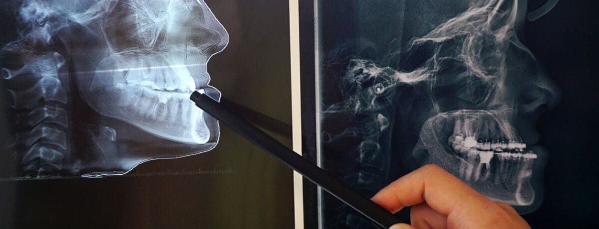 Rééducation maxillo-faciale