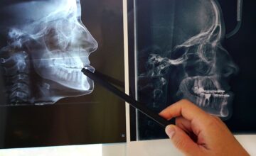 CT scans of teeth before and after orthodontic treatment. preparation for maxillofacial surgery. High quality photo CT scans of teeth before and after orthodontic treatment. preparation for maxillofacial surgery. High quality photo