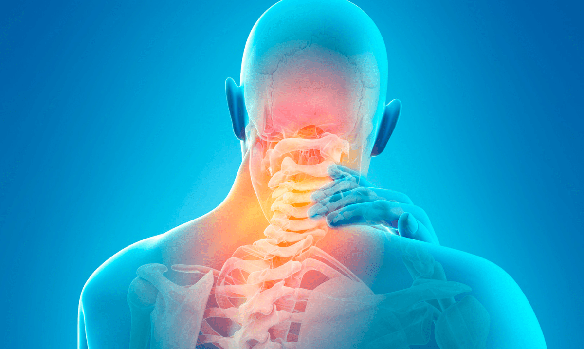 Cervicalgie: Du diagnostic au traitement