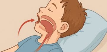 Effets de la thérapie myofonctionnelle orofaciale sur la croissance cranio-maxillo-faciale des enfants atteints de SAHOS : une revue systématique