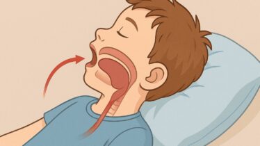 formation-kine-kinesitherapie-therapie-myofonctionnelle-orofaciale-enfant-apnee-obstructive-du-sommeil-fknl-nancy-lorraine