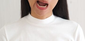 Physiothérapie pour la paralysie faciale idiopathique : une revue systématique