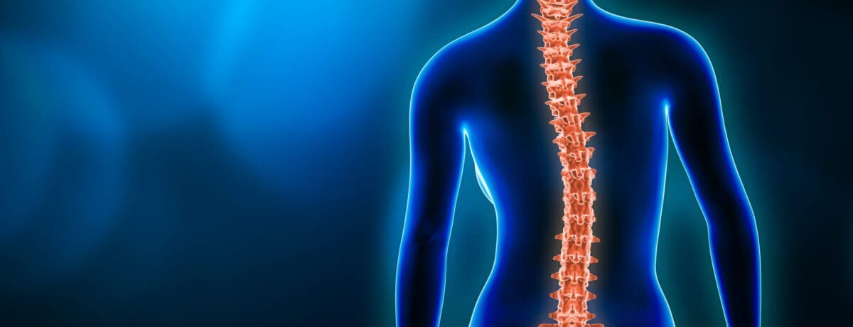 Scolioses idiopathiques