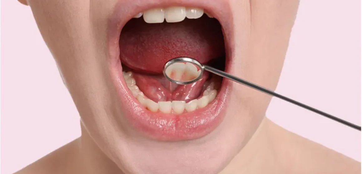 1-floor-of-mouth-cancer-thumbnail