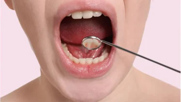 1-floor-of-mouth-cancer-thumbnail