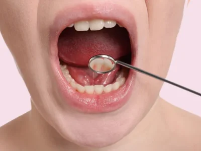 1-floor-of-mouth-cancer-thumbnail